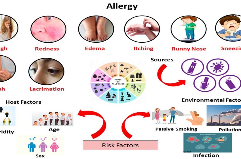 Allergy: Immune Causes, Symptoms, Diagnosis & Treatment Guide