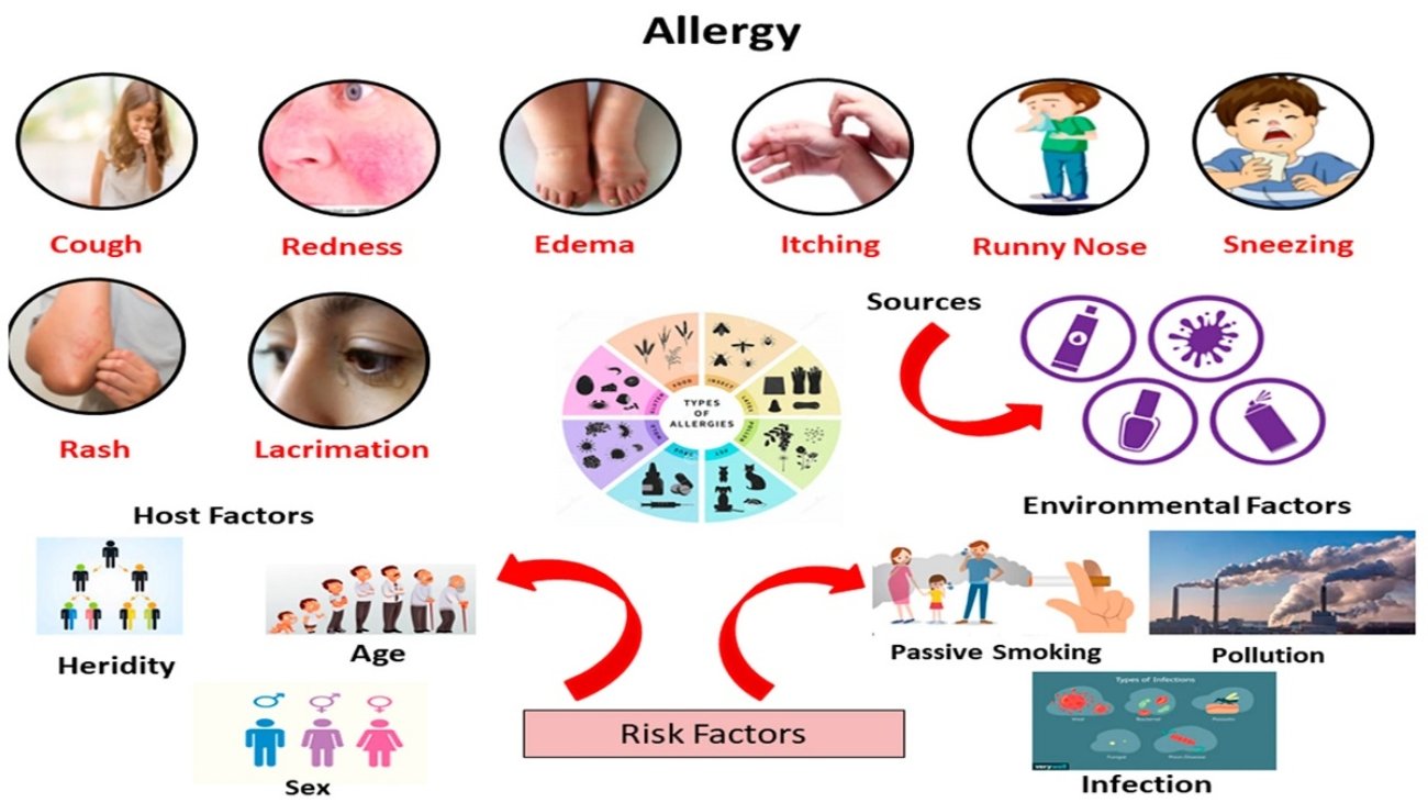 Allergy Immune Causes, Symptoms, Diagnosis & Treatment Guide