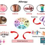 Allergy: Immune Causes, Symptoms, Diagnosis & Treatment Guide