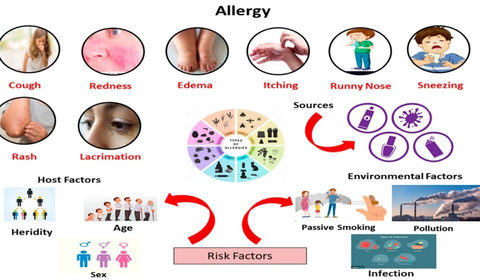 Allergy Immune Causes, Symptoms, Diagnosis & Treatment Guide